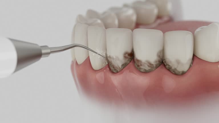 Reliable Dental contractor in El Rio, CA by Smile Center Dentistry